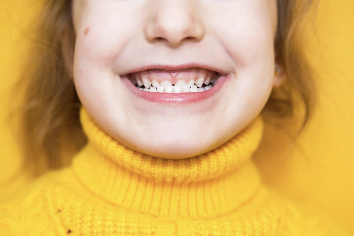 Maloclusión dental niños León