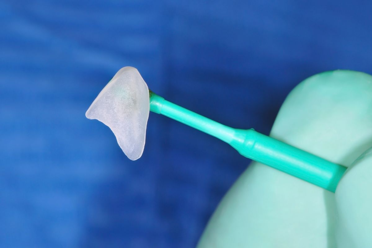 microcarillas dentales